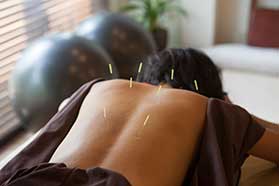 Acupuncture Clinic in New Port Richey, FL