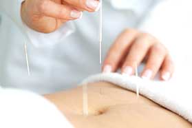 Acupuncture for digestion problems in Land O Lakes, FL