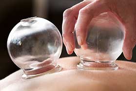 cupping therapy massage in Toluca Lake, CA