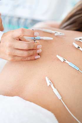 Electroacupuncture in Knoxville, TN